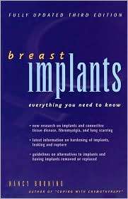 Breast Implants: Everything You Need to Know, (0897933710), Nancy 