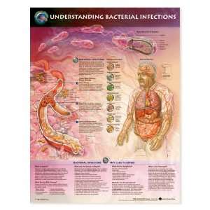  LWW Understanding Bacterial Infections Anatomical Chart 