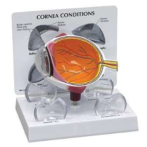  Cornea Eye Cross Section: Health & Personal Care