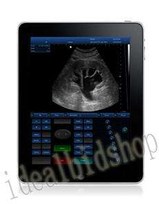 New 3D Full Digital ipadScan Ultrasound Scanner (PC) Touch Screen 