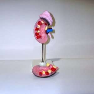  3 Piece Kidney model on stand